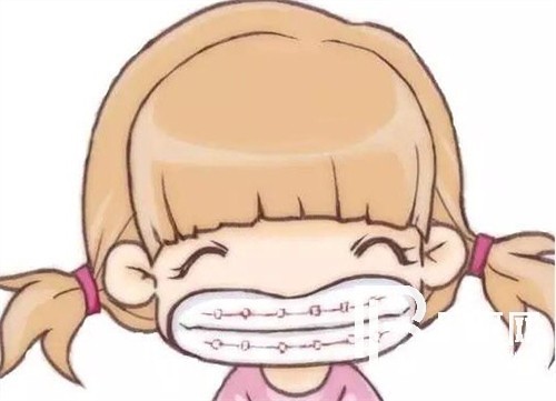 上海鑫齒口腔牙齒矯正好嗎？時(shí)代天使和隱適美有效果差別嗎？