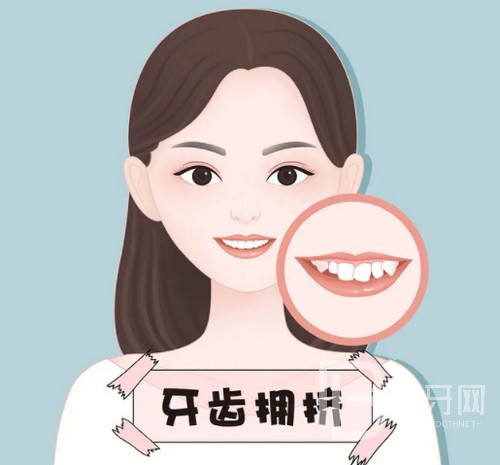 北京牙齒矯正大概要花費(fèi)多少錢(qián)？公布2022年北京牙齒矯正價(jià)目表