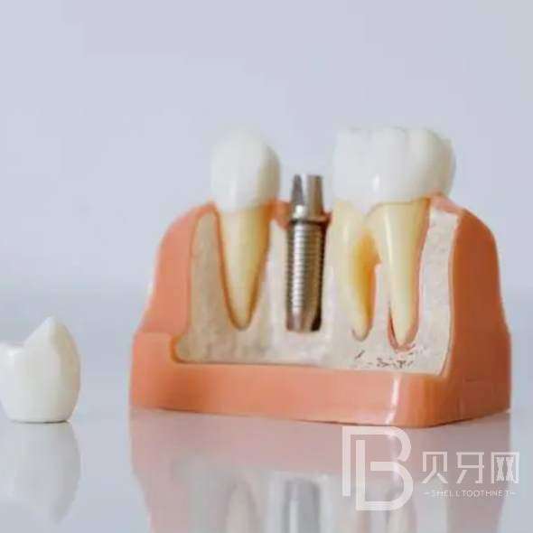 杭州牙齦紅腫最好的口腔醫(yī)院排行榜！杭州容勝口腔門診部業(yè)內(nèi)威望高！