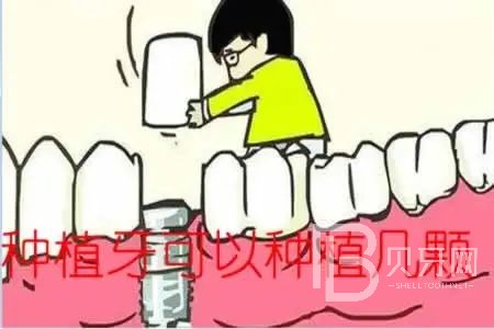 allon6種植牙是什么意思？東莞拜爾口腔